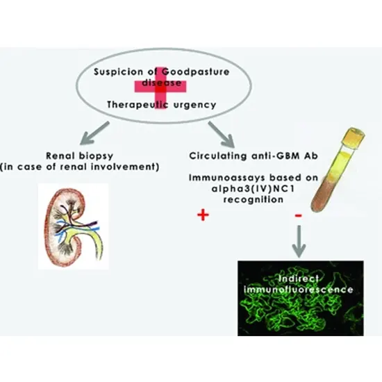 Anti-Glomerular Basement Membrane (GBM) Antibody by ELISA